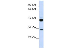 Flt3 Ligand antibody used at 1 ug/ml to detect target protein. (FLT3LG 抗体  (N-Term))