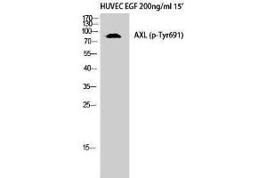 Western Blotting (WB) image for anti-AXL Receptor tyrosine Kinase (AXL) (pTyr691) antibody (ABIN3179699) (AXL 抗体  (pTyr691))