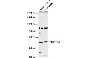 Western blot analysis of extracts of various cell lines, using NPFFR2 antibody (ABIN6128377, ABIN6144766, ABIN6144767 and ABIN6214924) at 1:3000 dilution. (NPFFR2 抗体  (AA 1-140))