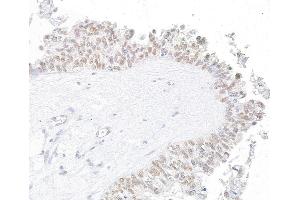 anti-Werner Helicase Interacting Protein 1 (WRNIP1) (AA 400-450) antibody