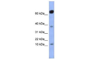 WB Suggested Anti-NKX6-3 Antibody Titration:  0. (NK6 Homeobox 3 抗体  (Middle Region))