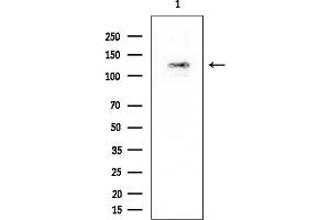 Western blot analysis of lysates from Rat testis, using ZO-2 Mouse Monoclonal Antibody at 1/1000 dilution.