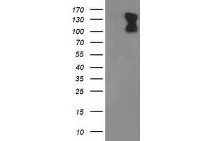 Western Blotting (WB) image for anti-phosphodiesterase 2A, CGMP-Stimulated (PDE2A) antibody (ABIN1500084) (PDE2A 抗体)