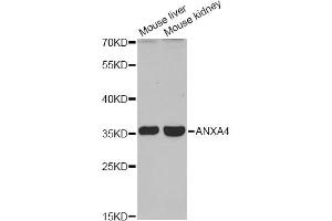 Western blot analysis of extracts of various cell lines, using ANXA4 antibody (ABIN6290015) at 1:1000 dilution. (Annexin IV 抗体)