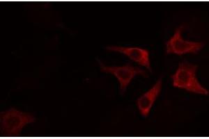 ABIN6274711 staining HeLa cells by IF/ICC. (AGPAT4 抗体  (Internal Region))