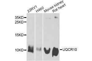 Western blot analysis of extracts of various cell lines, using UQCR10 antibody. (UQCR10 抗体)