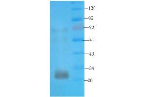 Western Blot using anti-syntaxin antibody ABIN7072248 Rat kidney lysate was resolved on a 12 % SDS PAGE gel and blots probed with ABIN7072248 at 3 μg/mL before being detected by a secondary antibody. (Recombinant Syntaxin 抗体)