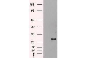 HEK293T cells were transfected with the pCMV6-ENTRY control (Left lane) or pCMV6-ENTRY HHex (RC204815) (Right lane) cDNA for 48 hrs and lysed. (HHEX 抗体  (AA 100-270))