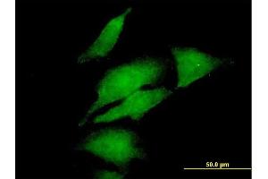 Immunofluorescence of purified MaxPab antibody to DGKA on HeLa cell. (DGKA 抗体  (AA 1-735))