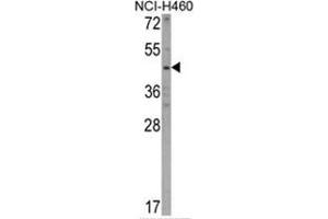 Western blot analysis of KYNU Antibody (C-term) in NCI-H460 cell line lysates (35ug/lane). (KYNU 抗体  (C-Term))