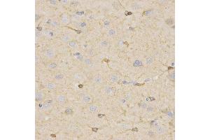 Immunohistochemistry (IHC) image for anti-Hydroxysteroid (17-Beta) Dehydrogenase 2 (HSD17B2) (AA 118-387) antibody (ABIN3015795)