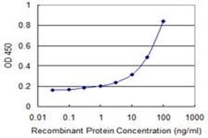 Detection limit for recombinant GST tagged TNRC6B is 0. (TNRC6B 抗体  (AA 153-252))