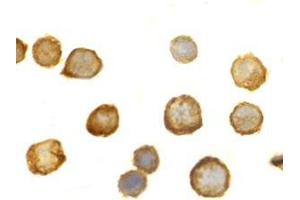 Immunocytochemistry of TLR5 in THP-1 cells with this product at 10 μg/ml. (TLR5 抗体  (C-Term))