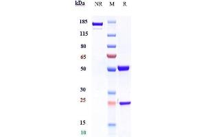 Anti-IL-5Ra/ CD125 Reference Antibody (benralizumab) on SDS-PAGE under reducing (R) condition. (Recombinant IL5RA (Benralizumab Biosimilar) 抗体)