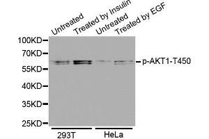 Western Blotting (WB) image for anti-V-Akt Murine Thymoma Viral Oncogene Homolog 1 (AKT1) (pThr450) antibody (ABIN1869963) (AKT1 抗体  (pThr450))