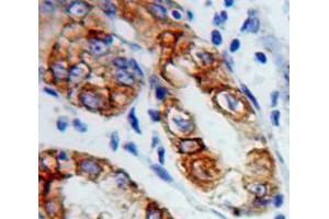 Used in DAB staining on fromalin fixed paraffin-embedded Stomach tissue (Connexin 31 抗体  (AA 7-102))