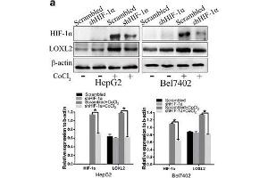 Western Blotting (WB) image for anti-Lysyl Oxidase-Like 2 (LOXL2) antibody (ABIN2856034)