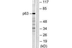 Western blot analysis of extracts from COS7 cells, using p63 antibody. (p63 抗体)