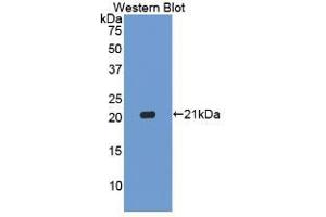 Western blot analysis of the recombinant protein. (Caspase 1 抗体  (AA 120-297))