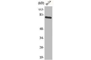 Western Blot analysis of HeLa cells using Phospho-p73 (Y99) Polyclonal Antibody
