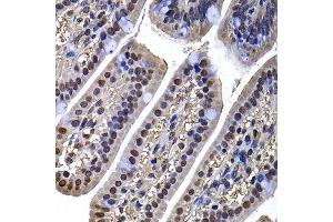 Immunohistochemistry (Paraffin-embedded Sections) (IHC (p)) image for anti-DnaJ (Hsp40) Homolog, Subfamily B, Member 6 (DNAJB6) (AA 177-326) antibody (ABIN6139713)