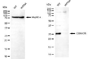 Western blotting analysis using CSNK2B antibody (ABIN7797884). (CSNK2B 抗体)