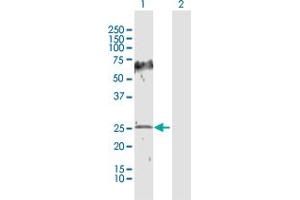Western Blot analysis of HPGD expression in transfected 293T cell line by HPGD MaxPab polyclonal antibody. (HPGD 抗体  (AA 1-266))