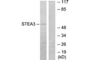 Western blot analysis of extracts from COLO205 cells, using STEA3 Antibody. (STEAP3 抗体  (AA 421-470))