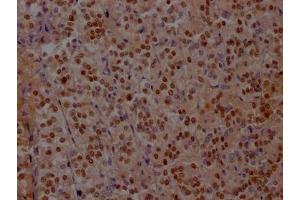IHC image of ABIN7127582 diluted at 1:100 and staining in paraffin-embedded human adrenal gland tissue performed on a Leica BondTM system. (Recombinant ISL1 抗体)