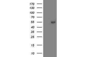 Western Blotting (WB) image for anti-Aminoacylase 1 (ACY1) antibody (ABIN1496456) (Aminoacylase 1 抗体)
