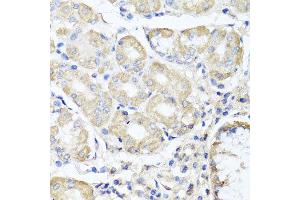 Immunohistochemistry of paraffin-embedded human gastric using OPA3 antibody at dilution of 1:100 (x40 lens). (OPA3 抗体)