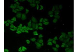 Detection of CD147 in Human Hela Cells using Polyclonal Antibody to Cluster Of Differentiation 147 (CD147) (CD147 抗体  (AA 79-280))