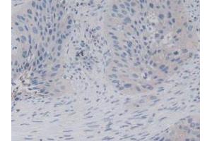 Immunohistochemistry (IHC) image for anti-Killer Cell Lectin-Like Receptor Subfamily D, Member 1 (KLRD1) (AA 32-179) antibody (ABIN7439108)