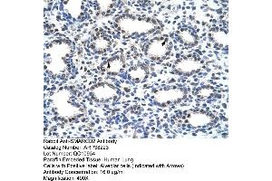Rabbit Anti-SMARCD2 Antibody  Paraffin Embedded Tissue: Human Lung Cellular Data: Alveolar cells Antibody Concentration: 16 ug/ml Magnification: 400X