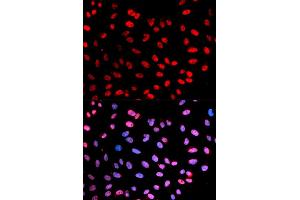 Immunofluorescence (IF) image for anti-Extra Spindle Poles Like 1 (ESPL1) (pSer1126) antibody (ABIN1876756) (Separase 抗体  (pSer1126))