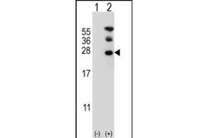 Western Blotting (WB) image for anti-RAN, Member RAS Oncogene Family (RAN) (AA 12-39), (N-Term) antibody (ABIN390647)