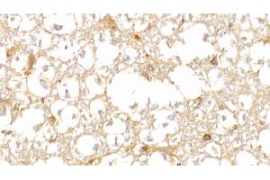 Detection of HbA1c in Human Spinal cord Tissue using Polyclonal Antibody to Glycated Hemoglobin A1c (HbA1c) (HbA1c 抗体)