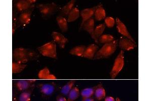 Immunofluorescence analysis of HeLa cells using ACVR2B Polyclonal Antibody at dilution of 1:100 (40x lens). (ACVR2B 抗体)