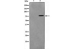 Western blot analysis on HuvEc cell lysate using TGM2 Antibody,The lane on the left is treated with the antigen-specific peptide. (Transglutaminase 2 抗体  (N-Term))