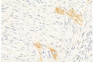 ABIN6261371 and ABIN6277296 at 1/100 staining Rat stomach tissue by IHC-P. (Dynamin 1-Like 抗体  (C-Term))