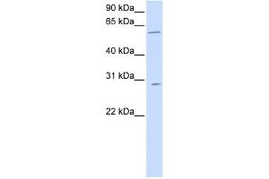 PNPLA4 antibody used at 1 ug/ml to detect target protein. (PNPLA4 抗体  (C-Term))