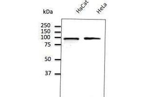 Anti-Calnexin ER membrane marker Ab (ABOC37) at 1/500 dilution, lysates at 50 µg per Iane, Rabbit potyctonal to goat lµg (HRP) at 1/10,000 dilution,