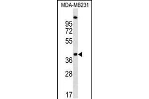 Western blot analysis in MDA-MB231 cell line lysates (35ug/lane). (RQCD1 抗体  (AA 106-134))