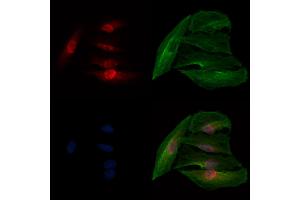 ABIN7093928 and ABIN7097972 staining  cells by IF/ICC. (NHP2 抗体  (Internal Region))