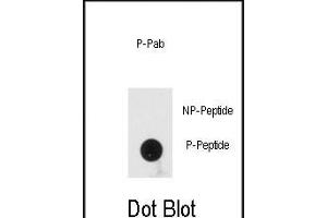 Dot blot analysis of anti-Phospho-PRKRA-p Antibody (ABIN389976 and ABIN2839767) on nitrocellulose membrane. (PRKRA 抗体  (pSer246))