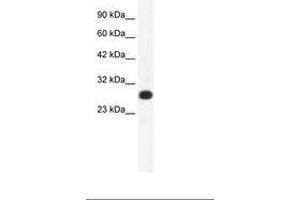 Image no. 1 for anti-General Transcription Factor IIF, Polypeptide 2, 30kDa (GTF2F2) (AA 132-181) antibody (ABIN202121) (GTF2F2 抗体  (AA 132-181))