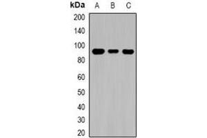 Western blot analysis of TGase1 expression in MCF7 (A), mouse kidney (B), rat brain (C) whole cell lysates. (TGM1 抗体)
