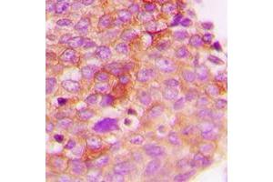Immunohistochemistry (IHC) image for anti-Insulin Receptor Substrate 1 (IRS1) (pSer307) antibody (ABIN7296034)