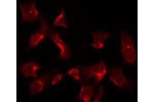 Immunofluorescence (fixed cells) (IF/ICC) image for anti-Prostaglandin-Endoperoxide Synthase 1 (Prostaglandin G/H Synthase and Cyclooxygenase) (PTGS1) (C-Term) antibody (ABIN6260980)