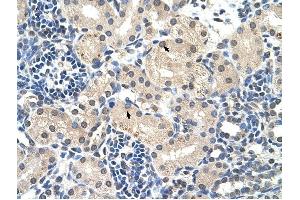 C14ORF130 antibody was used for immunohistochemistry at a concentration of 4-8 ug/ml to stain Epithelial cells of renal tubule (arrows) in Human Kidney. (UBR7 抗体  (Middle Region))